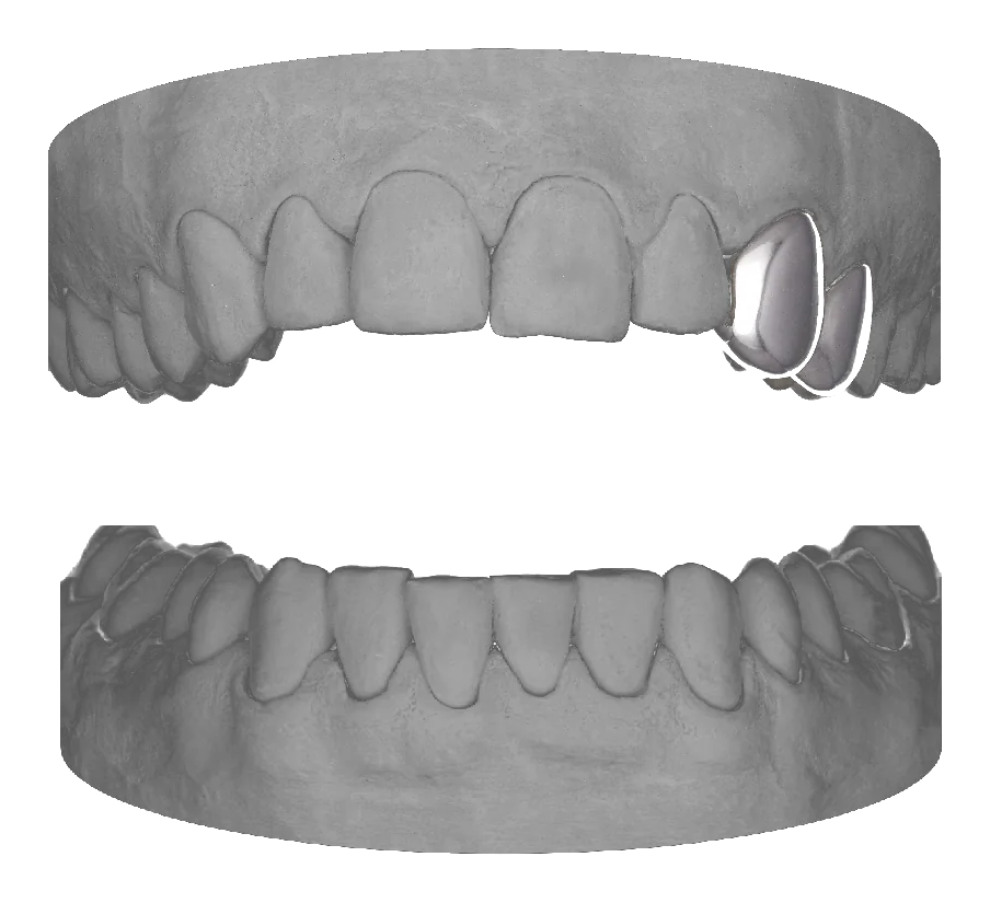 Canine Premolar