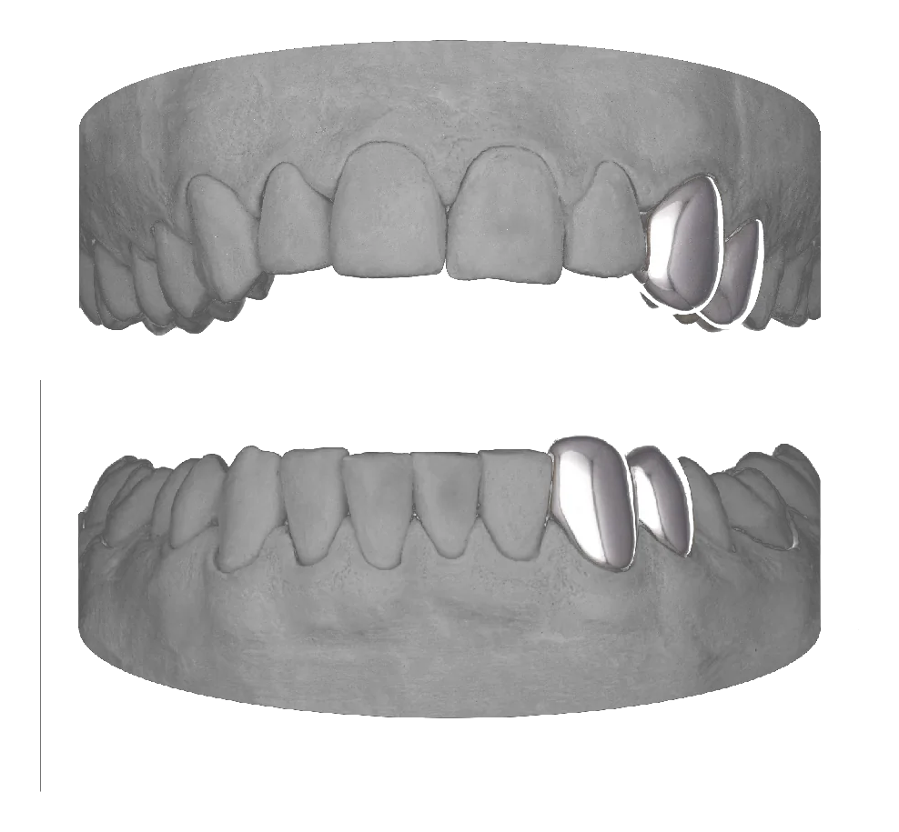 2x Canine Premolar Upper & Lower