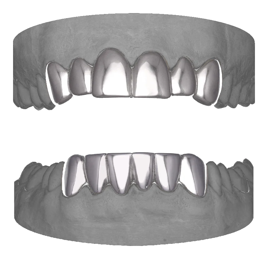 6 Set Upper & Lower