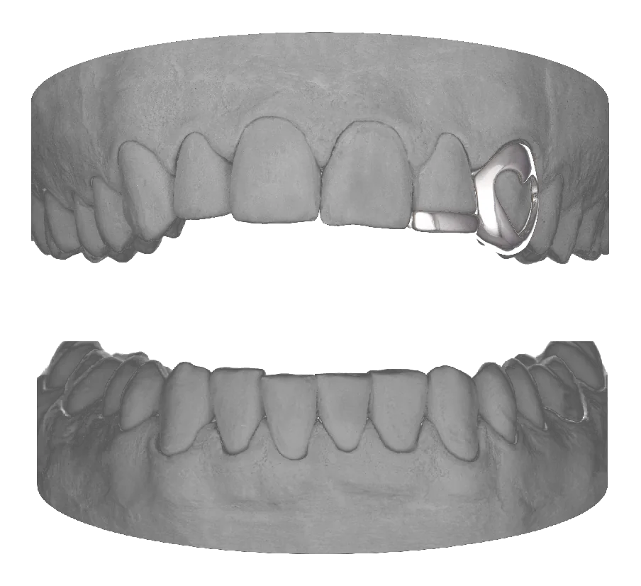 Heart Canine Bar