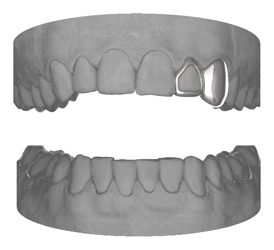 Window Lateral Canine