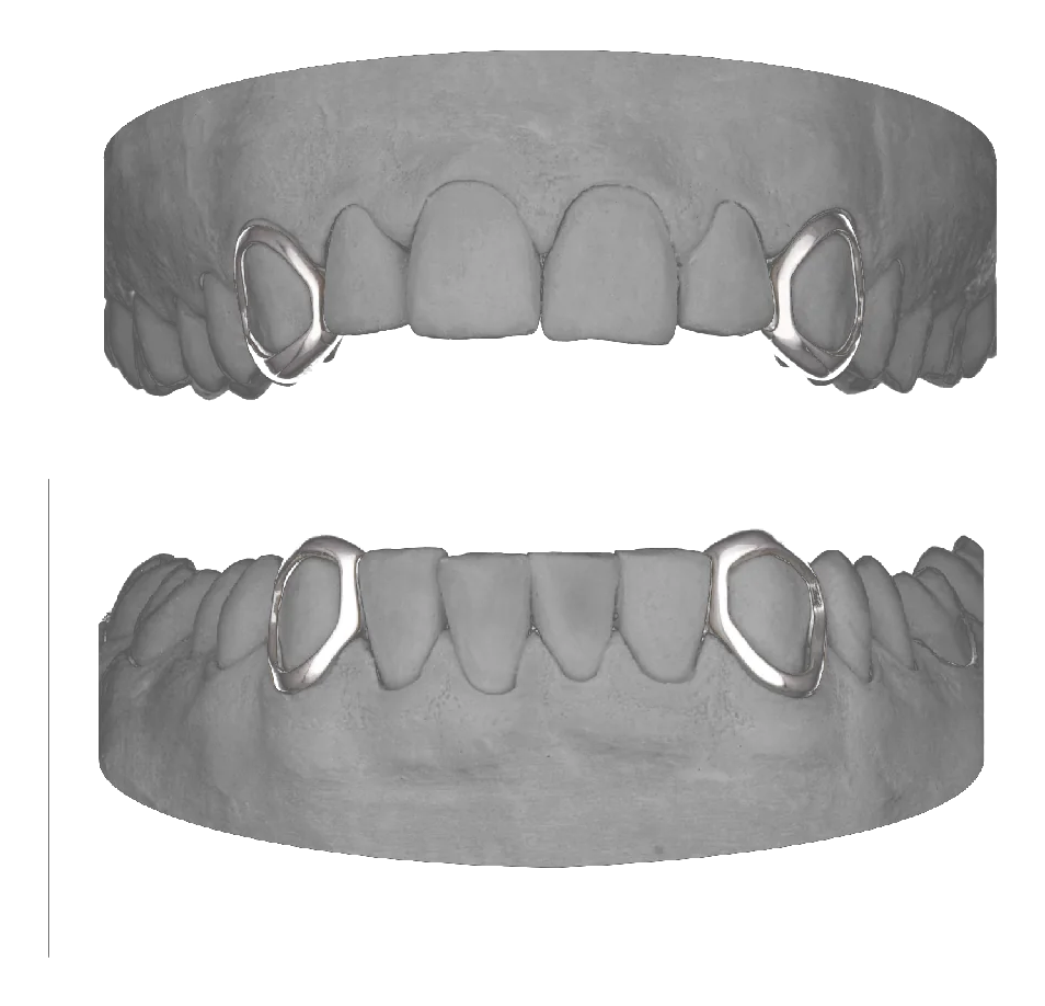 4x Window Canines
