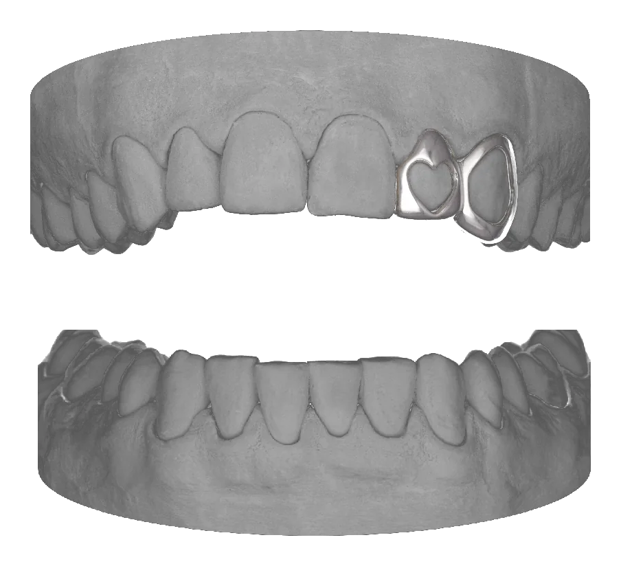 Heart Lateral Window Canine