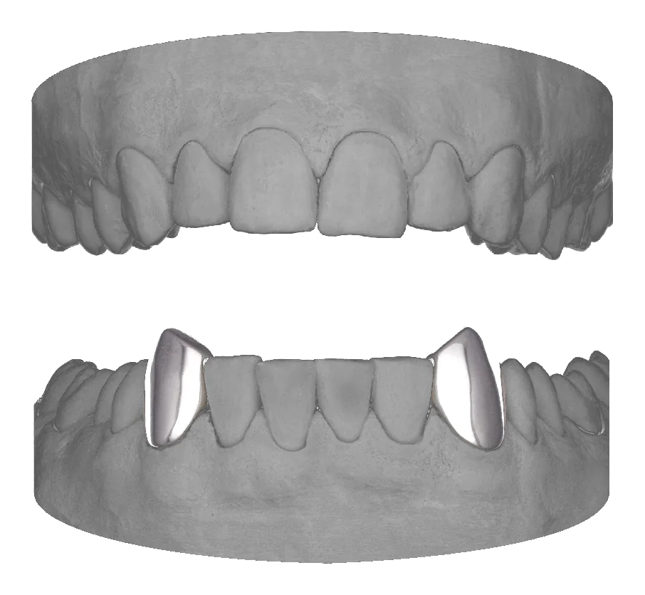 2x Vampire Canines Lower